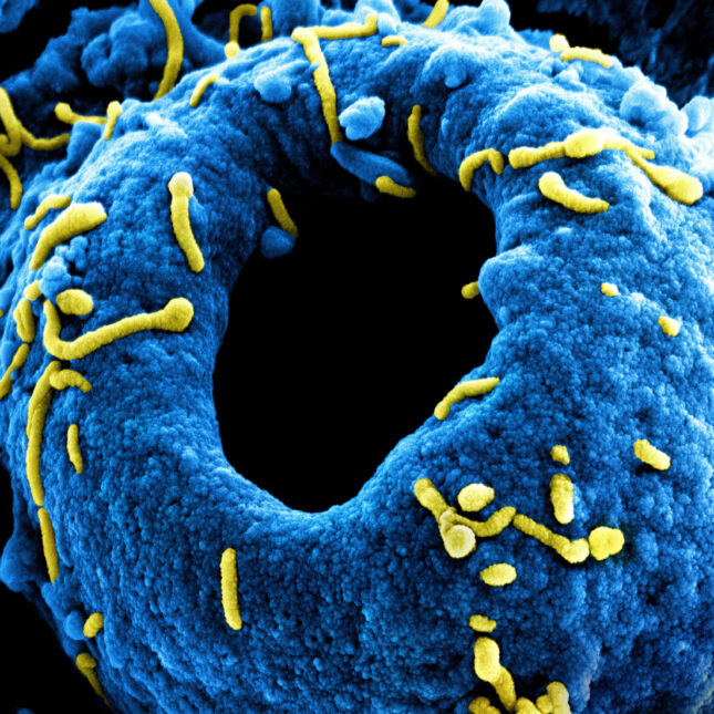 Marburg Virus Particles Colorized scanning electron micrograph of Marburg virus particles (yellow) both budding and attached to the surface of an infected VERO E6 cell (blue). -- infectious disease coverage from STAT