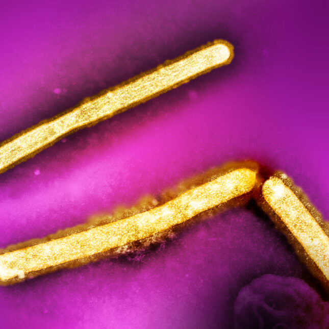 Three influenza A (H5N1/bird flu) virus particles (rod-shaped; yellow) with a purple background.