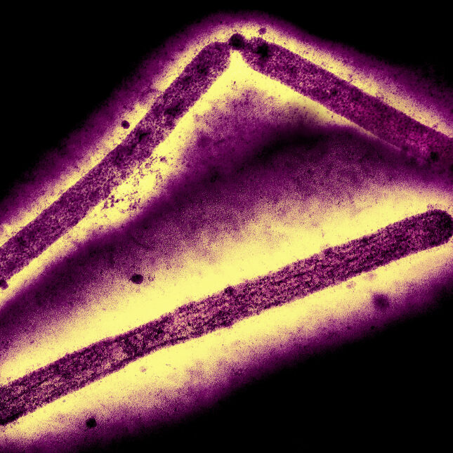 Influenza A Virus (H5N1/Bird Flu) Three influenza A (H5N1/bird flu) virus particles (rod-shaped; purple). -- infectious disease coverage from STAT