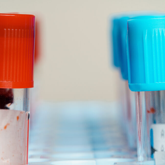 A tray that contains test tubes with red cap on the left, test tubes with blue cap on the right, and an empty row in the middle — health coverage from STAT