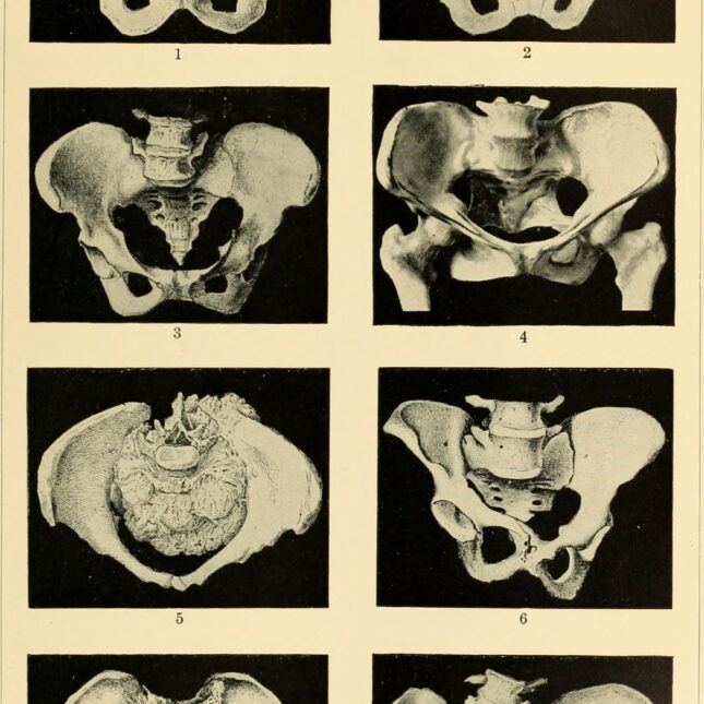 1897 obstetrics textbook. -- first opinion coverage from STAT