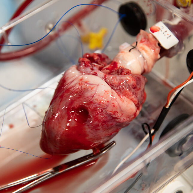 Boston, MA -- 06/27/24 -- A pig heart is seen hooked up to the Ex Vivo system, also know as the "heart in a box" system, which provides organ perfusion, at Massachusetts General Hospital, on June 27, 2024, in Boston, Massachusetts. The system oxygenates, warms, and pumps blood through the heart to re-animate and keep it alive and viable for transplant.