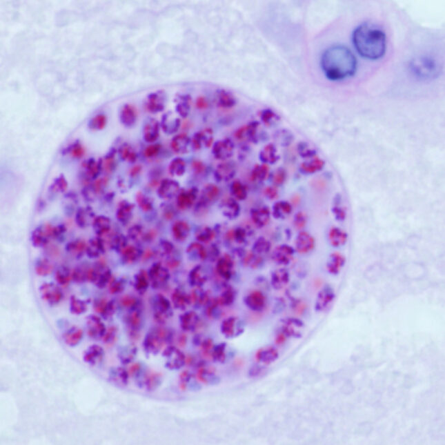 Under a microscope, a circle in light pink contains little balls of purple — coverage from STAT